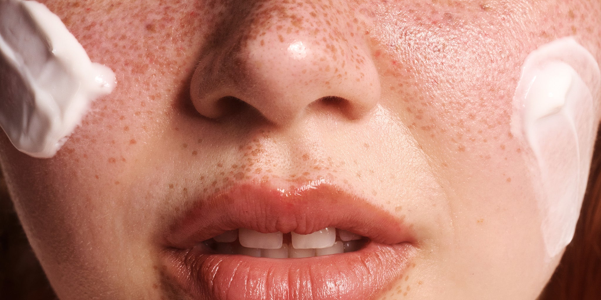 Sensitive skin guide: What is it and how to care for it